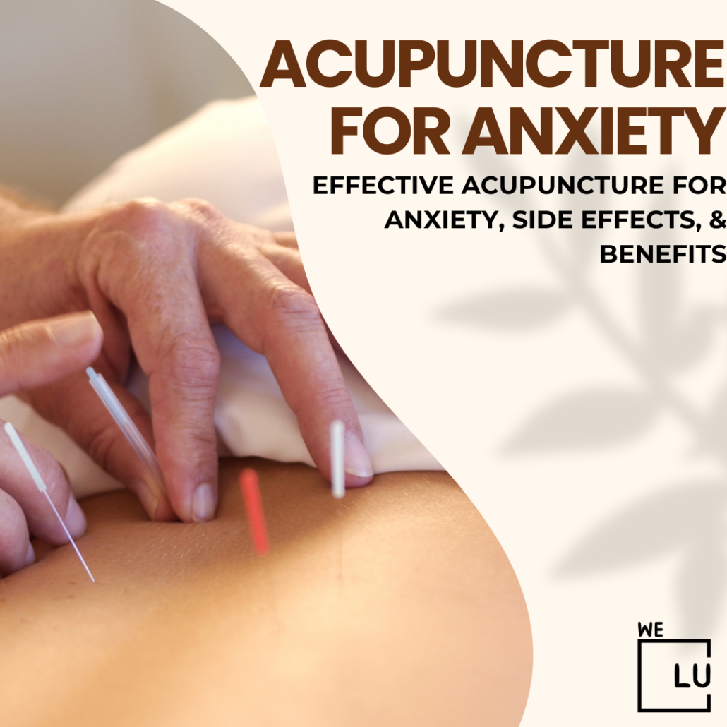 Some individuals grappling with depression and anxiety are exploring alternative treatments like acupuncture.