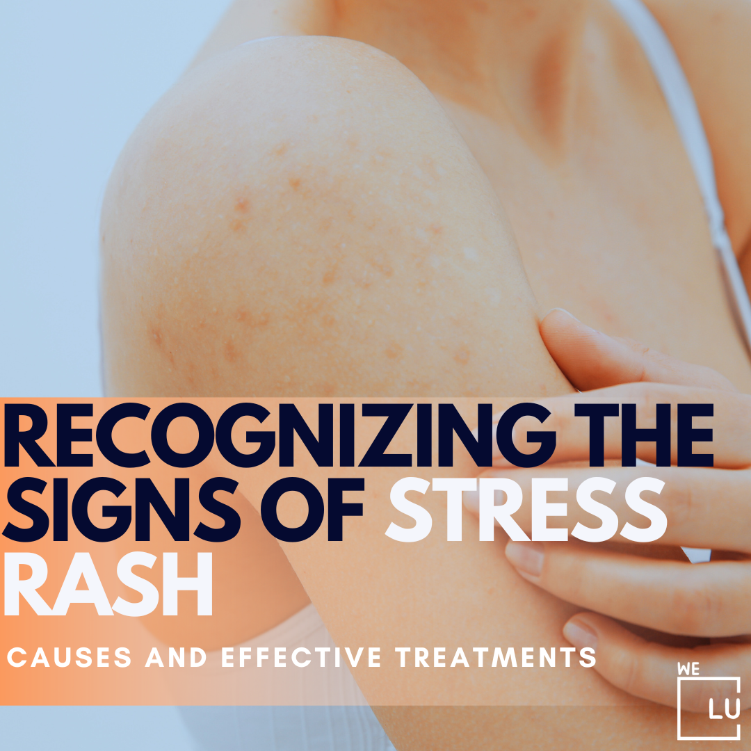 What To Know About Stress Rash Causes Effects Treatment